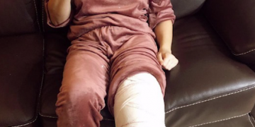 Paula Ripoll, de l’Handbol Amposta, operada amb èxit de lligaments creuats i menisc