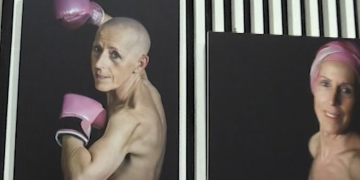 Exposició fotogràfica sobre el càncer de mama a Tortosa